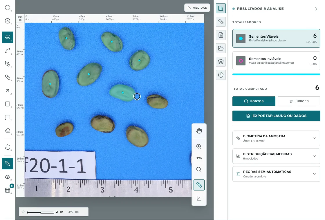 Tela do SeedCounter com 10 sementes de fava sobre fundo azul e uma régua em centímetros embaixo. Seis estão contornadas e marcadas com um ponto ciano, e quatro ainda estão sem contorno. O painel mostra 6 sementes viáveis.